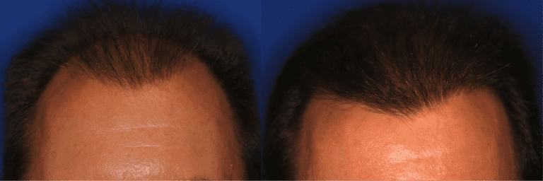 The Irvine Institute of Medicine & Cosmetic Surgery after — Irvine, CA