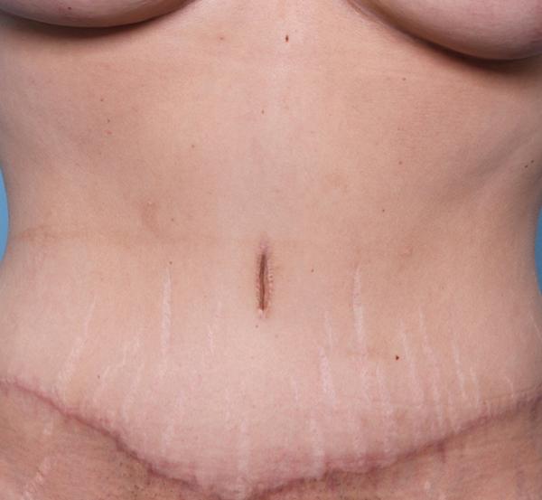 Nebraska Medicine Village Pointe Aesthetic Surgery | Dreams MedSpa provider photo