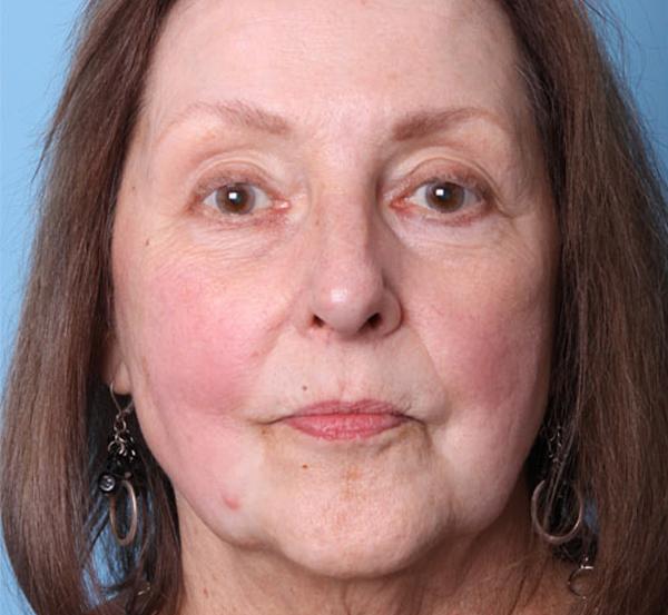 Nebraska Medicine Village Pointe Aesthetic Surgery | Dreams MedSpa provider photo