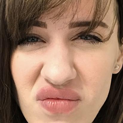 Spa Trouvé botox after — Orem, UT