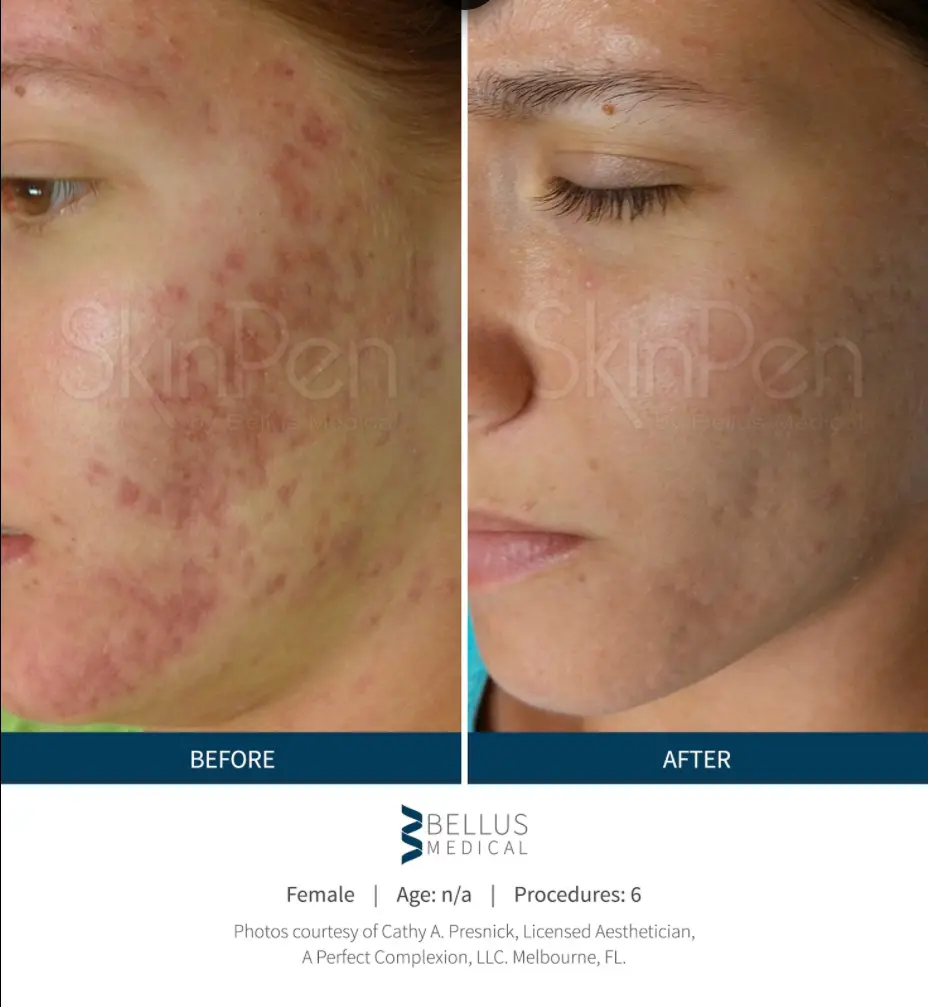 Ogden Clinic Dermatology result — Ogden, UT