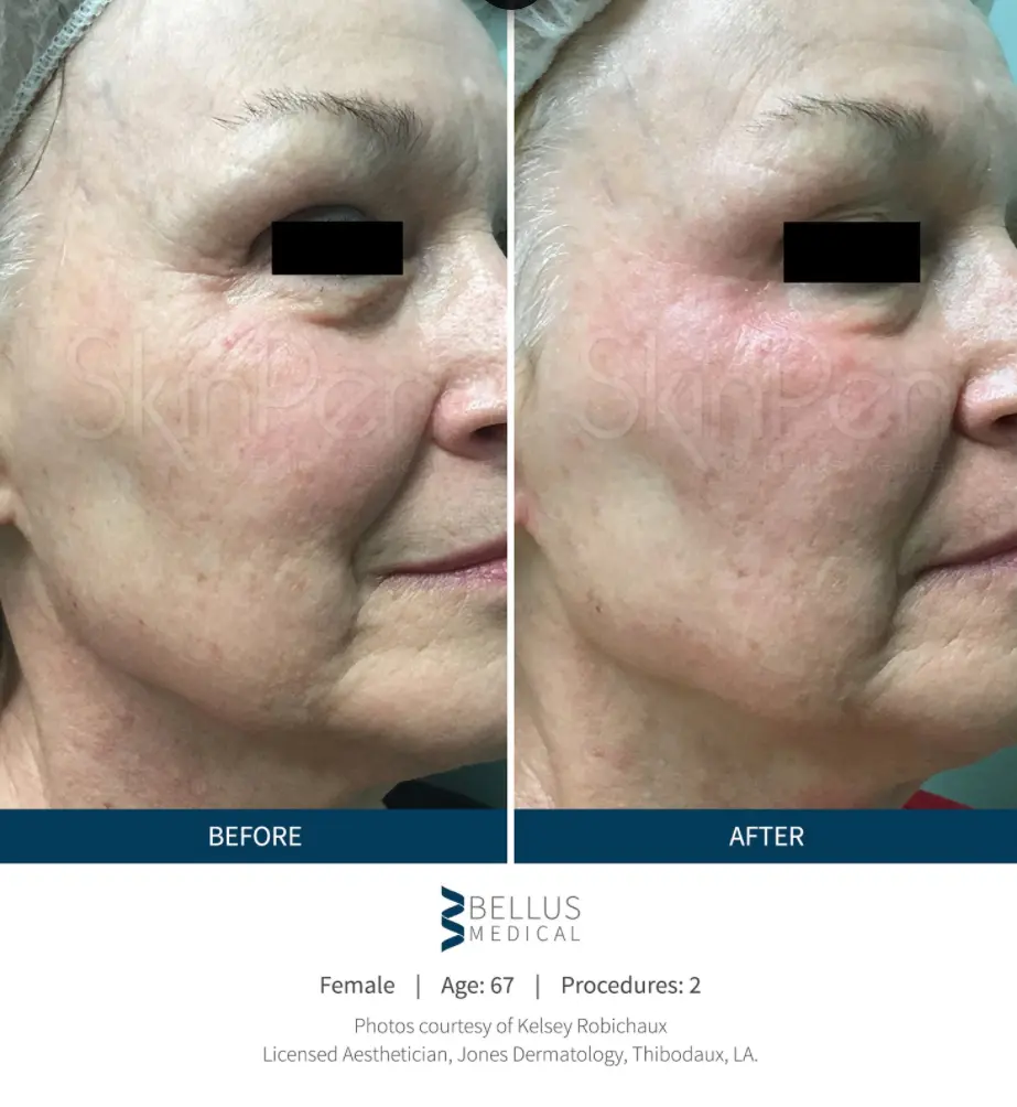Ogden Clinic Dermatology result — Ogden, UT