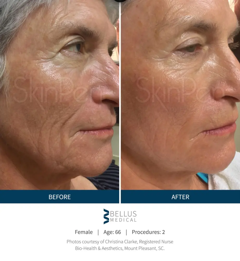 Ogden Clinic Dermatology result — Ogden, UT