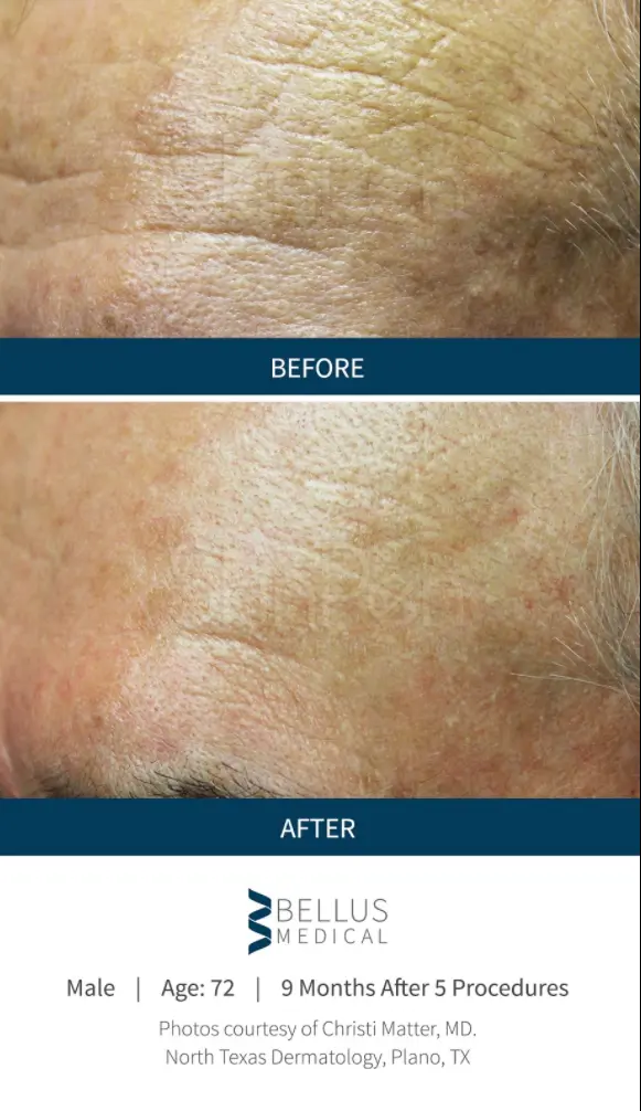 Ogden Clinic Dermatology result — Ogden, UT