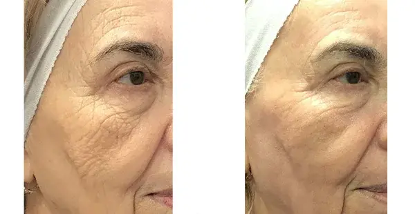 KHROM MEDSPA & WELLNESS result — Brooklyn, NY