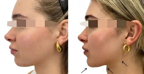 KHROM MEDSPA & WELLNESS result — Brooklyn, NY