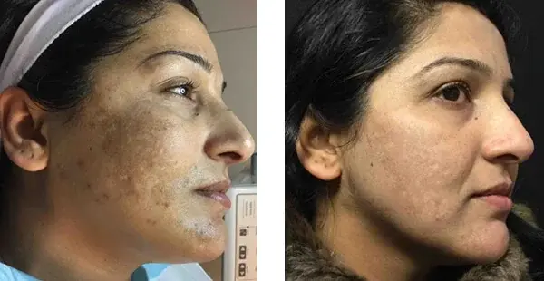 KHROM MEDSPA & WELLNESS result — Brooklyn, NY
