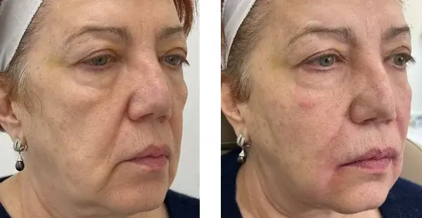 KHROM MEDSPA & WELLNESS result — Brooklyn, NY