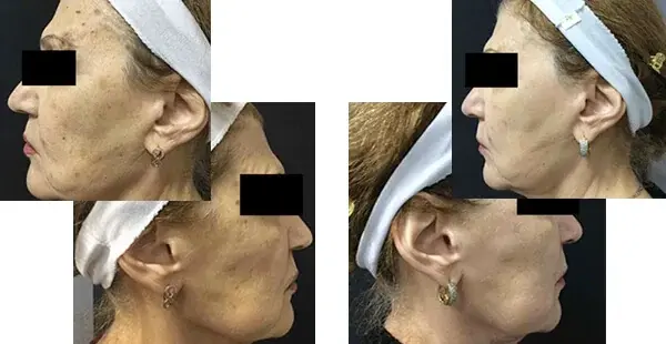 KHROM MEDSPA & WELLNESS result — Brooklyn, NY