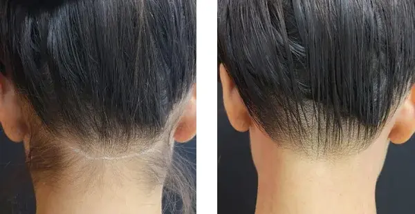 KHROM MEDSPA & WELLNESS result — Brooklyn, NY