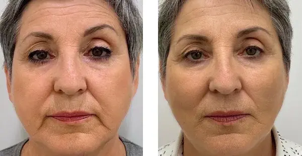 KHROM MEDSPA & WELLNESS result — Brooklyn, NY