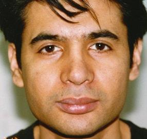 Elias Gikas, MD rhinoplasty after — Chicago, IL