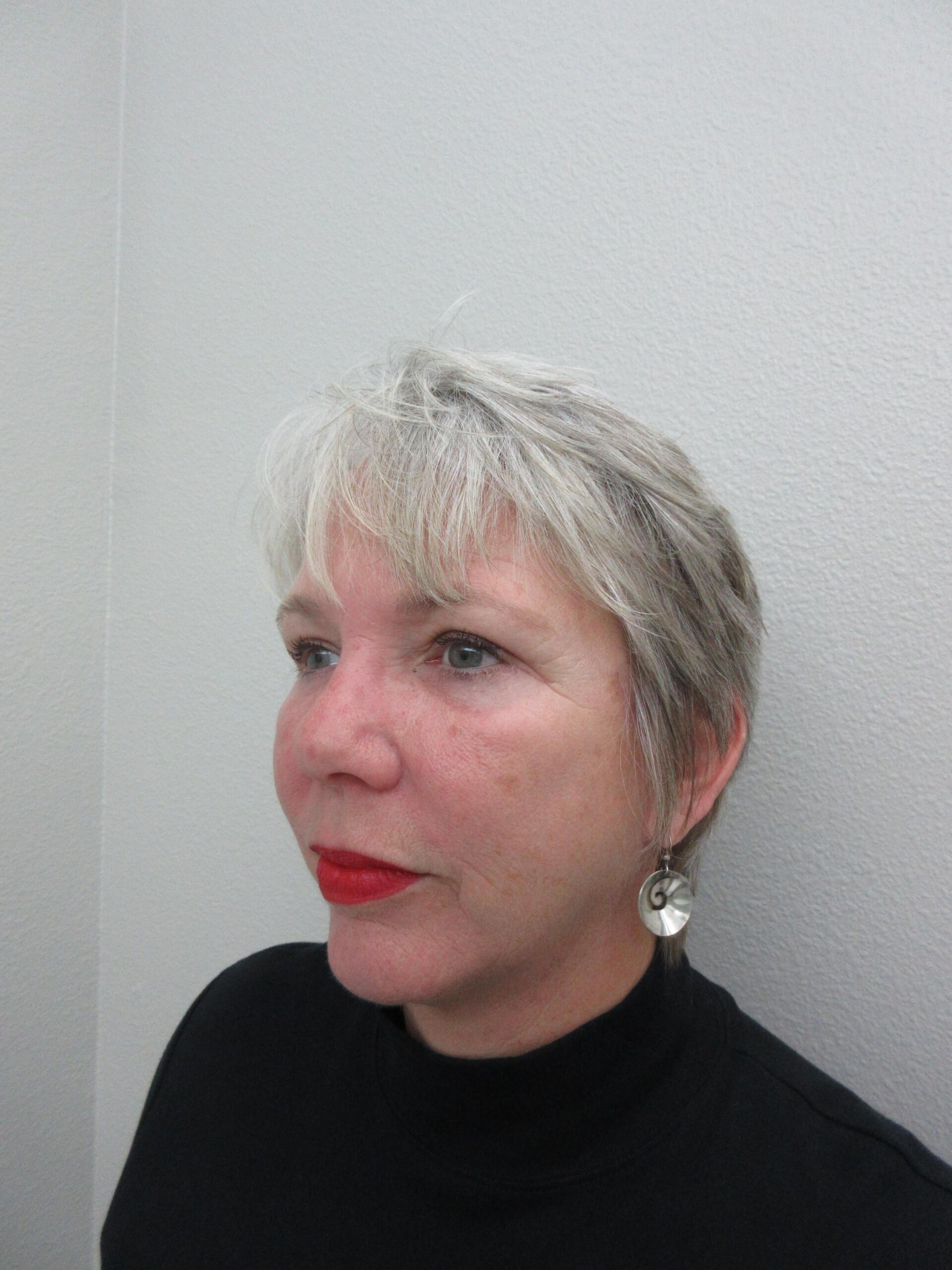 Plastic Surgery Central Florida facelift after — Orlando, FL