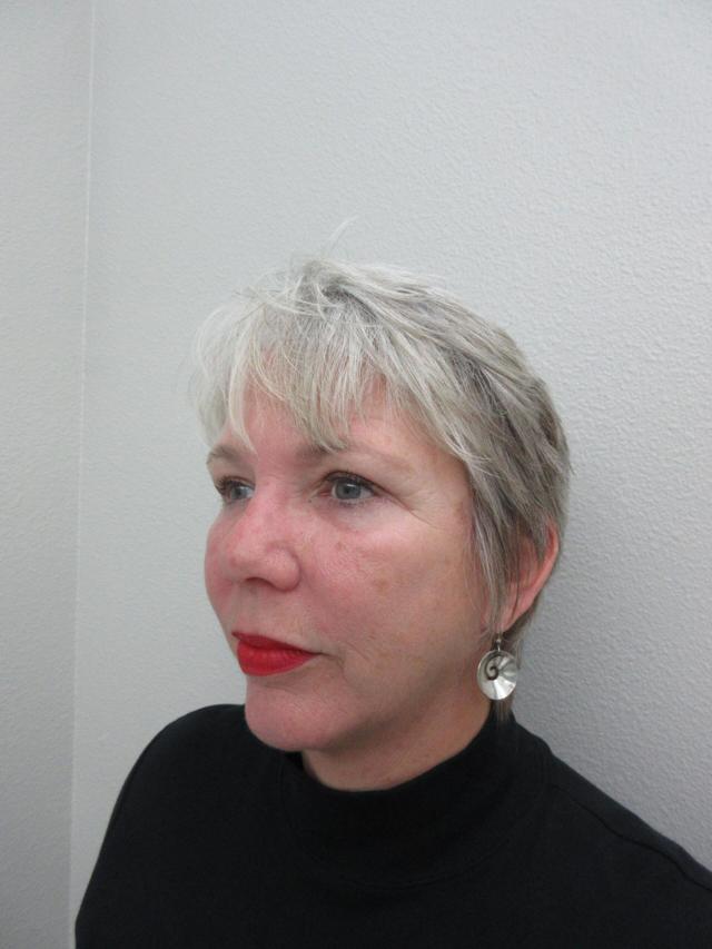 Deep Plane Facelift after at Plastic Surgery Central Florida in Orlando, FL