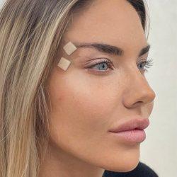 Med Spa NYC: Beso Aesthetics after — New York, NY