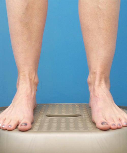 Liposuction after at Crispin Plastic Surgery in Atlanta, GA