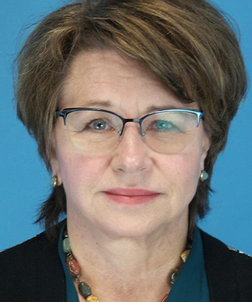 Crispin Plastic Surgery facelift after — Atlanta, GA