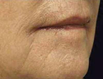 Plastic Surgery Specialists after — Greenbrae, CA