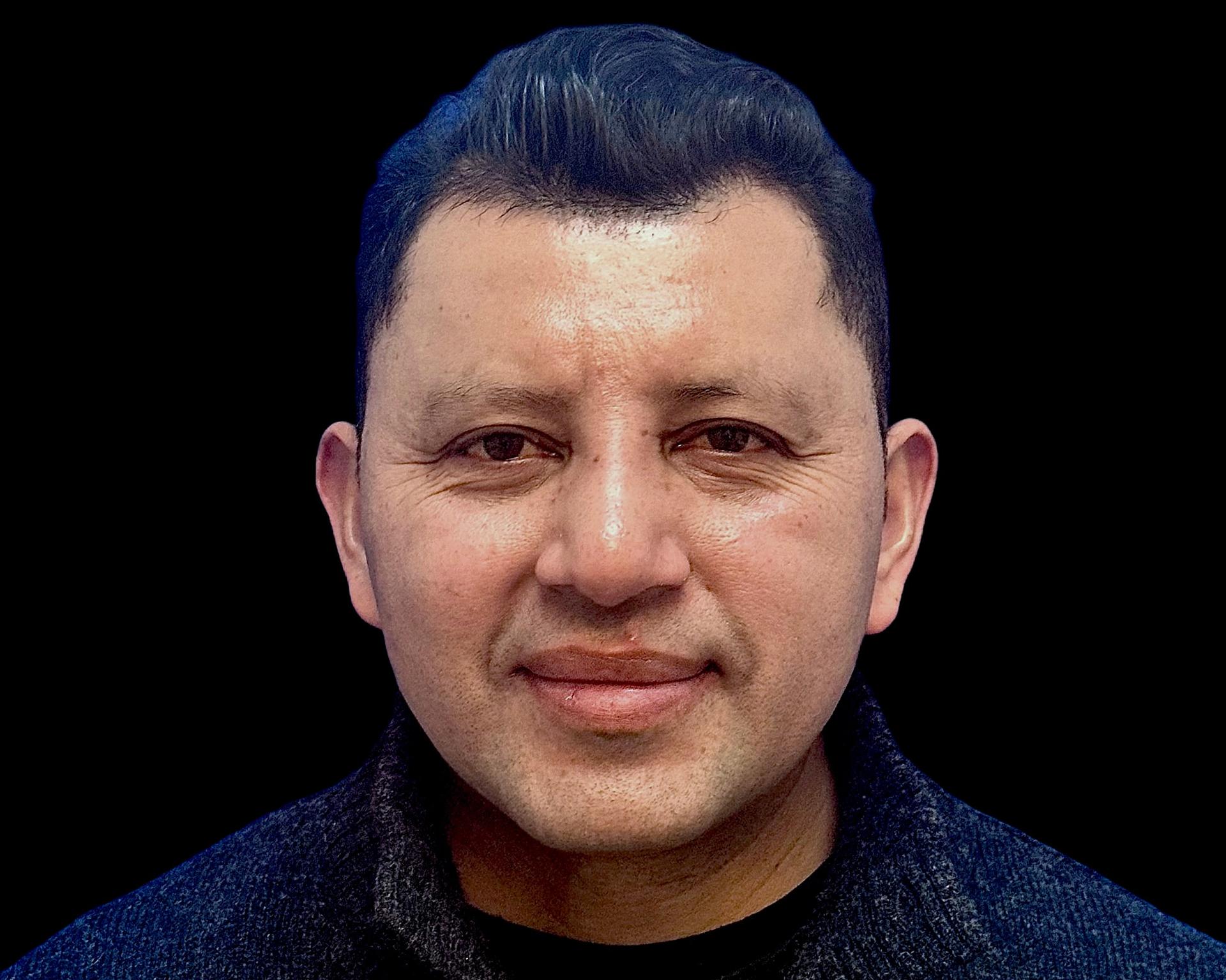 Shah Plastic Surgery, PLLC rhinoplasty after — New York, NY