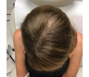 Dermatology & Laser of Alabama after — Birmingham, AL