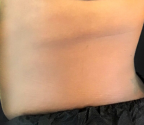 Dermatology & Laser of Alabama after — Birmingham, AL