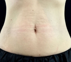 Dermatology & Laser of Alabama after — Birmingham, AL