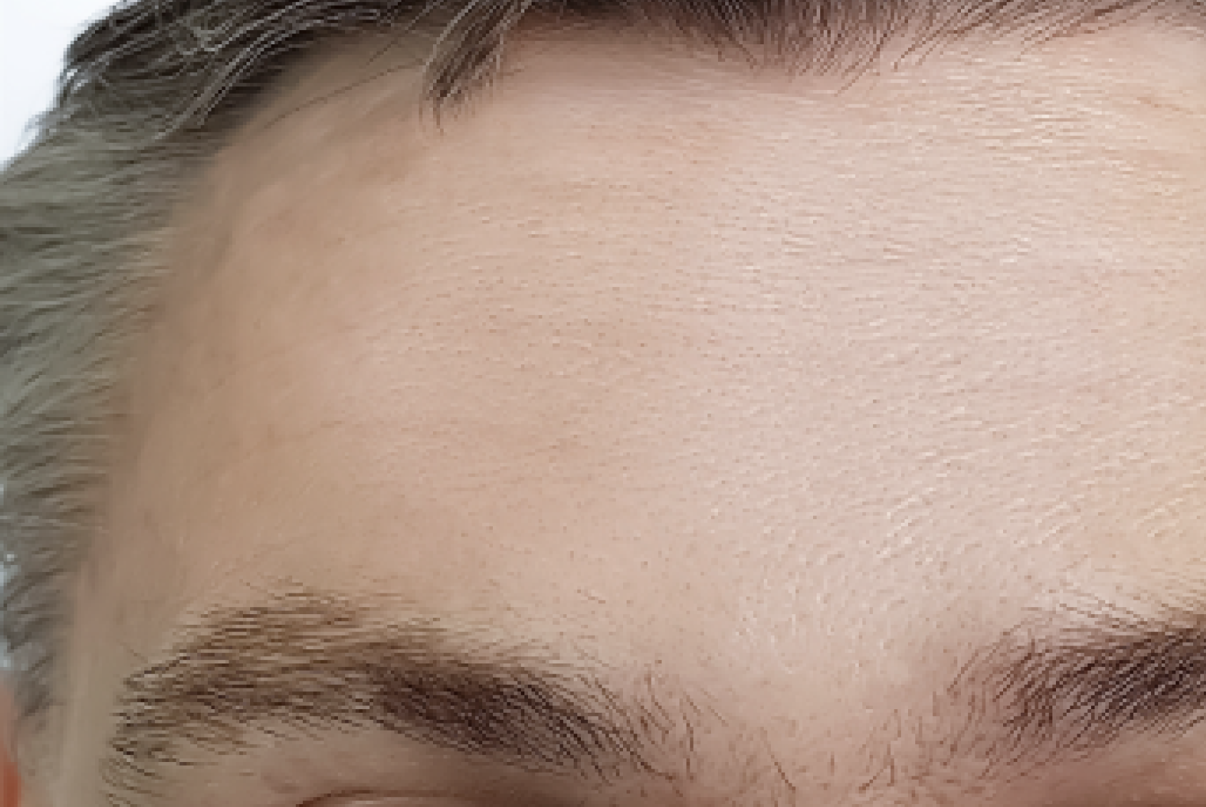 NKC Aesthetics after — North Kansas City, MO