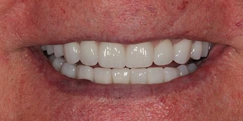Franklin Smiles provider photo