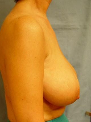 Dr. Lorelle L. Kramer, MD - Aesthetic and Cosmetic Plastic Surgery Center, LLC of Greater Milwaukee provider photo