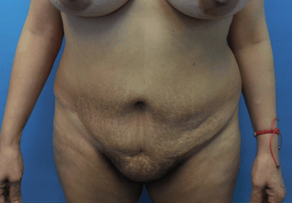 Dr. Lorelle L. Kramer, MD - Aesthetic and Cosmetic Plastic Surgery Center, LLC of Greater Milwaukee provider photo