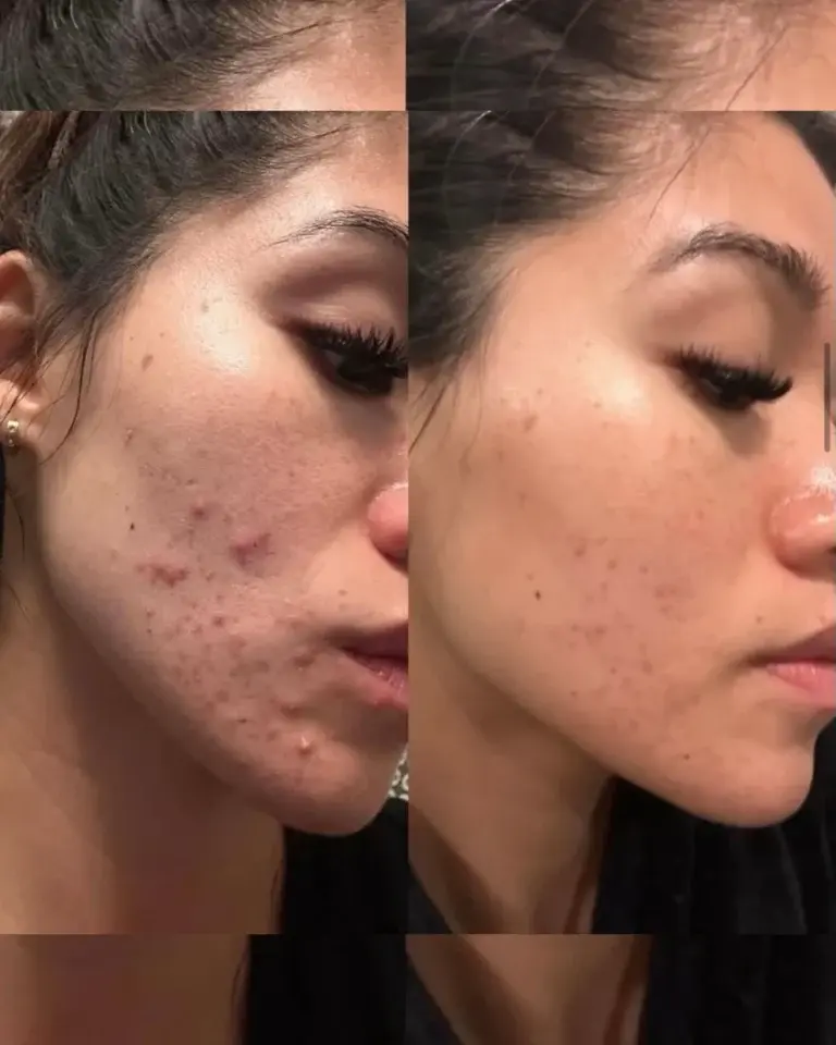 Optimal Health Family Practice & Medspa result — Provo, UT