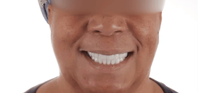 Smile Makeover after at Dental Design Studios (Dentista) in Nashville, TN