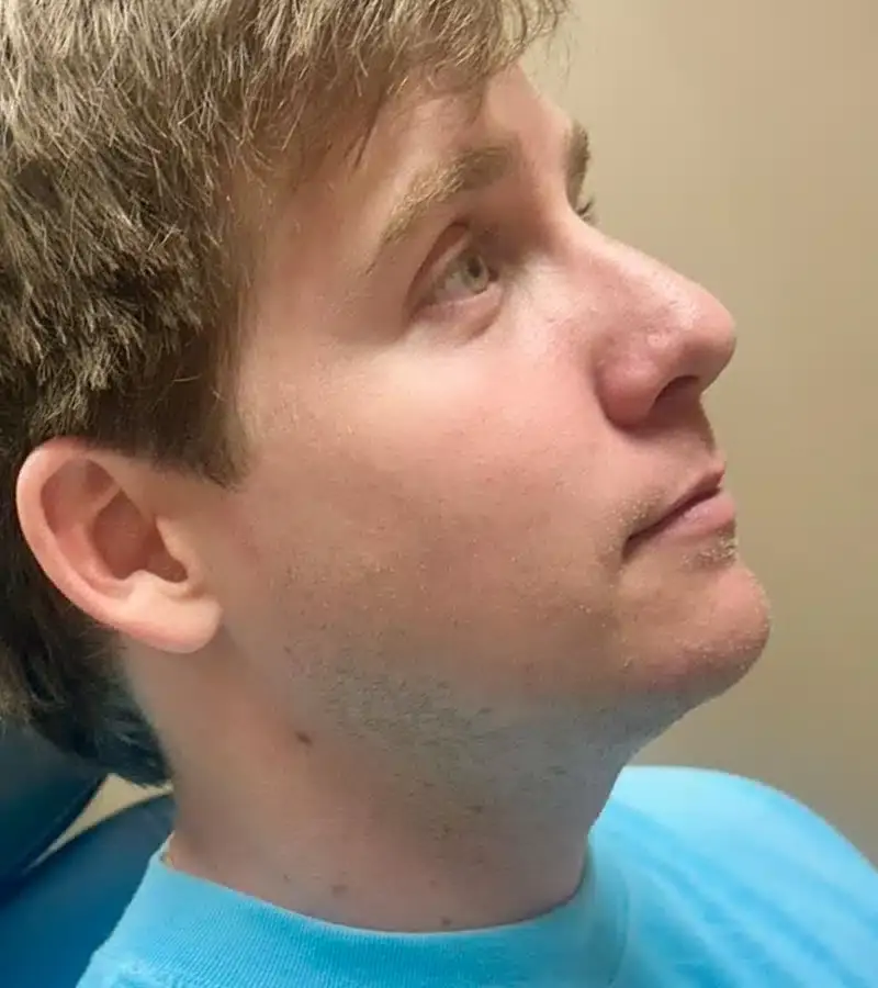 Infinity Med-I-Spa after — Birmingham, AL