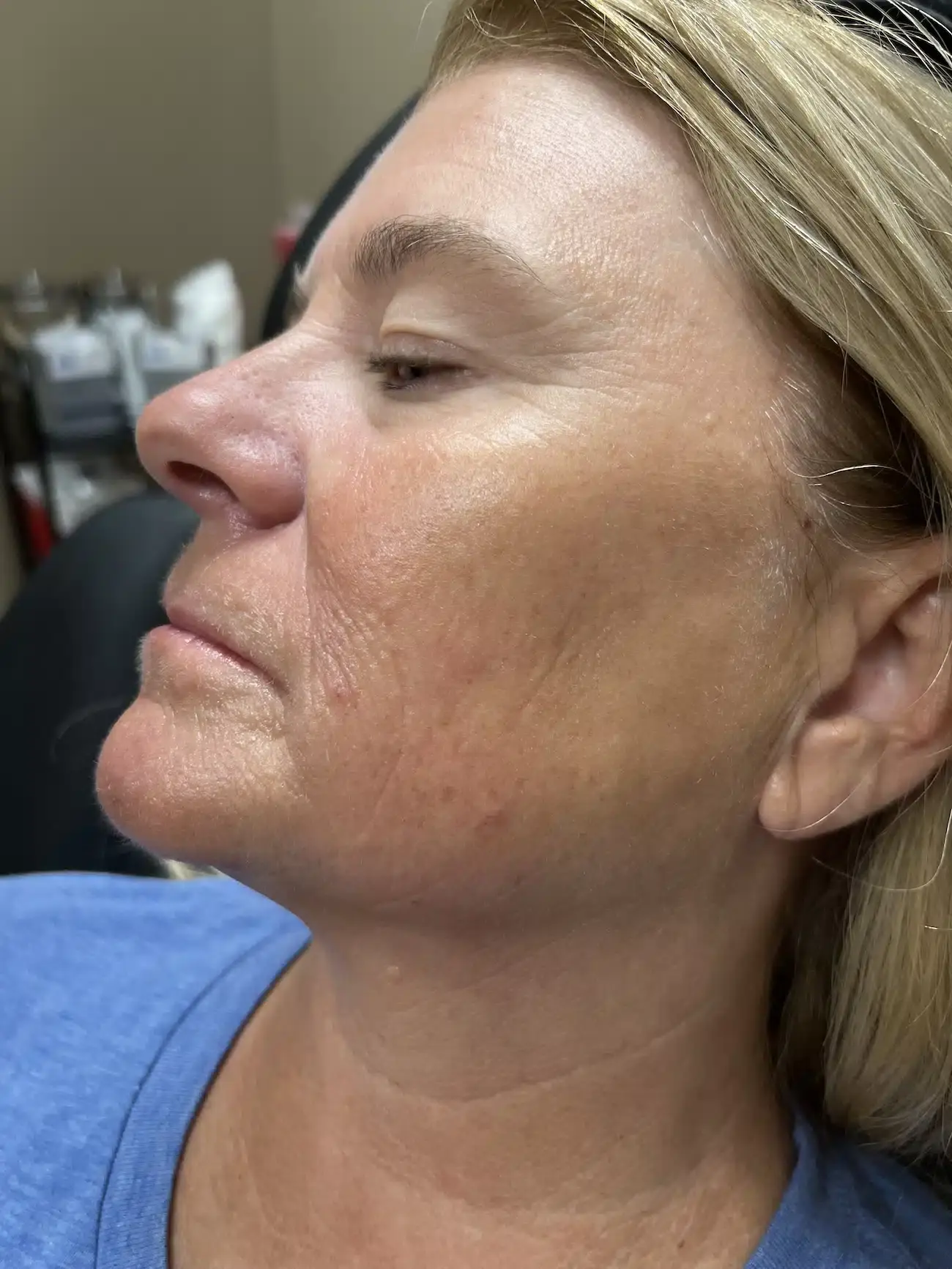Infinity Med-I-Spa after — Birmingham, AL
