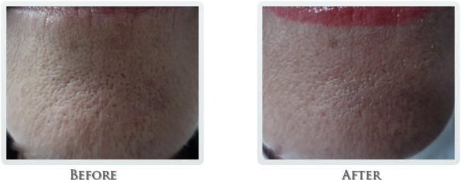 Thrive Aesthetic & Wellness result — Portland, OR