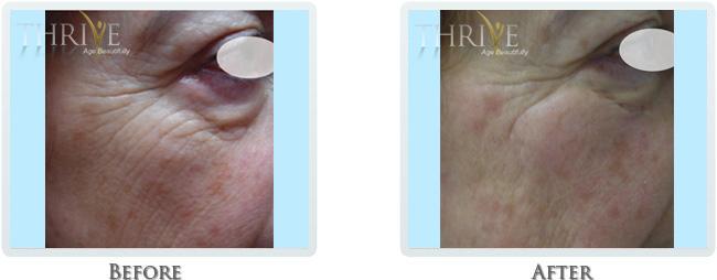 Thrive Aesthetic & Wellness result — Portland, OR