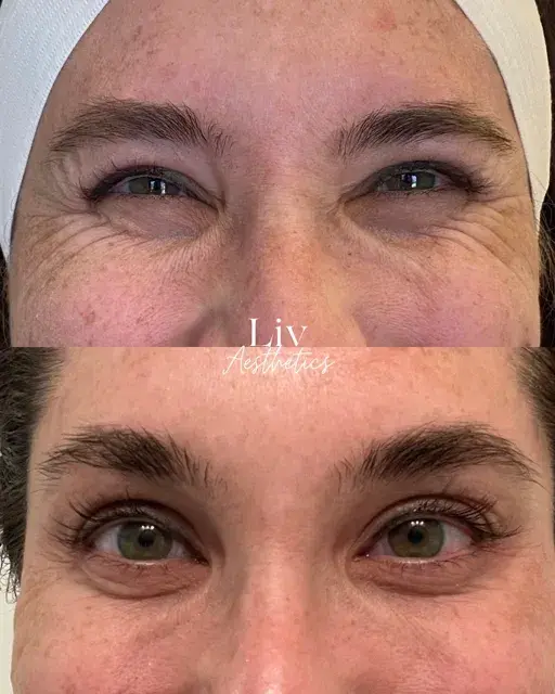 Liv Aesthetics & Wellness result — South Jordan, UT