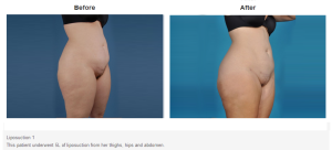 Bradley Hubbard, MD result — Plano, TX