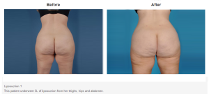 Bradley Hubbard, MD result — Plano, TX