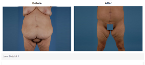Bradley Hubbard, MD result — Plano, TX