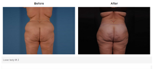 Bradley Hubbard, MD result — Plano, TX