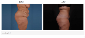 Bradley Hubbard, MD result — Plano, TX
