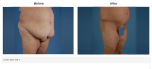 Bradley Hubbard, MD result — Plano, TX
