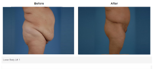 Bradley Hubbard, MD result — Plano, TX