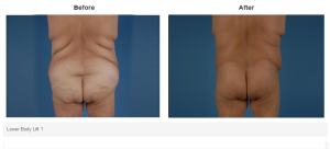 Bradley Hubbard, MD result — Plano, TX