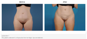 Bradley Hubbard, MD result — Plano, TX