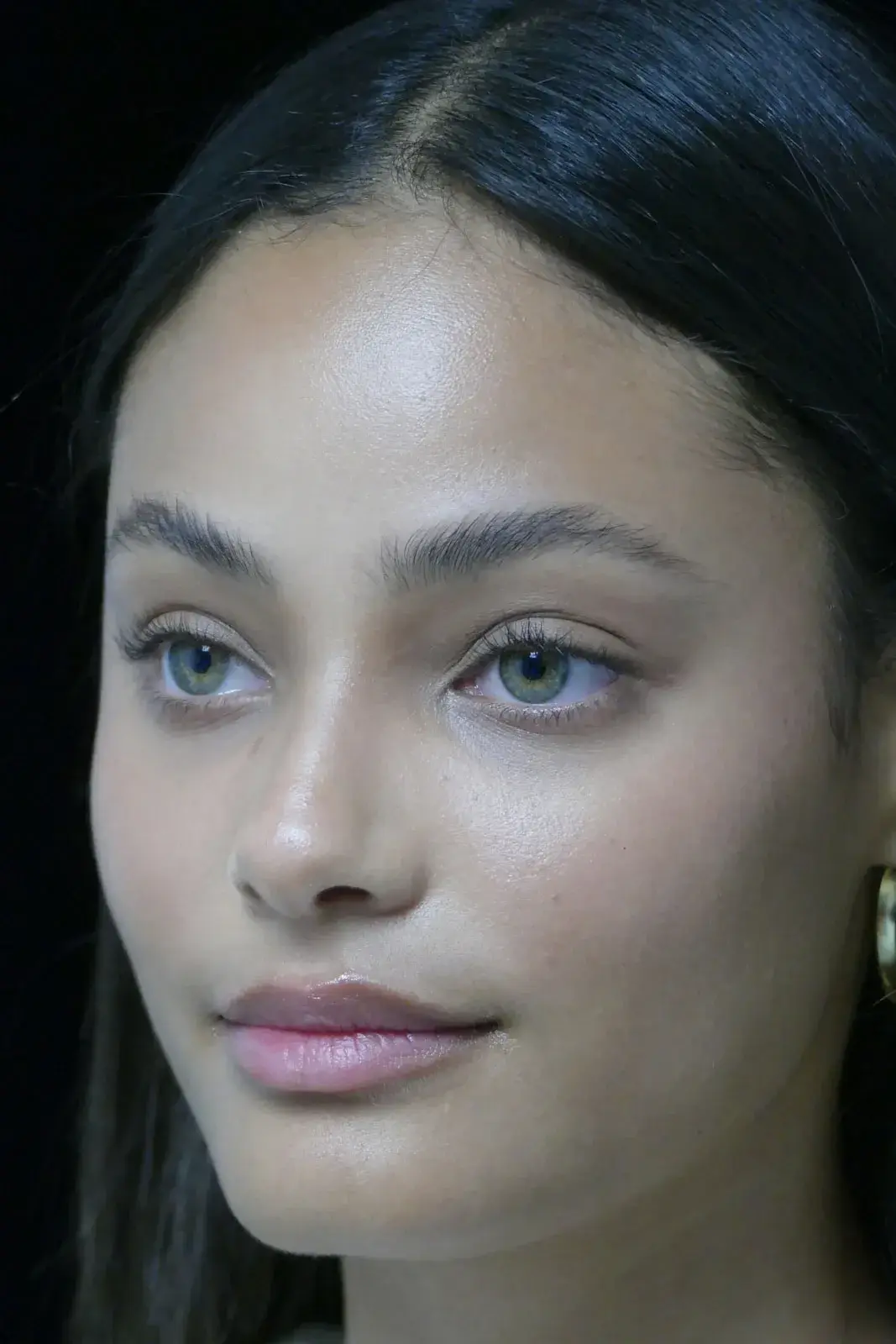 Dr. Kanodia Rhinoplasty rhinoplasty after — Beverly Hills, CA