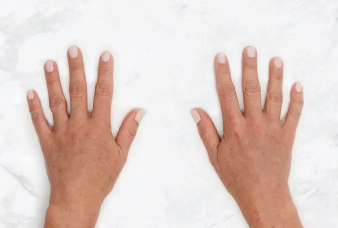 SANT Aesthetics & Regenerative Medicine after — Portland, OR