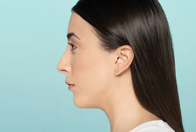 SANT Aesthetics & Regenerative Medicine rhinoplasty after — Portland, OR