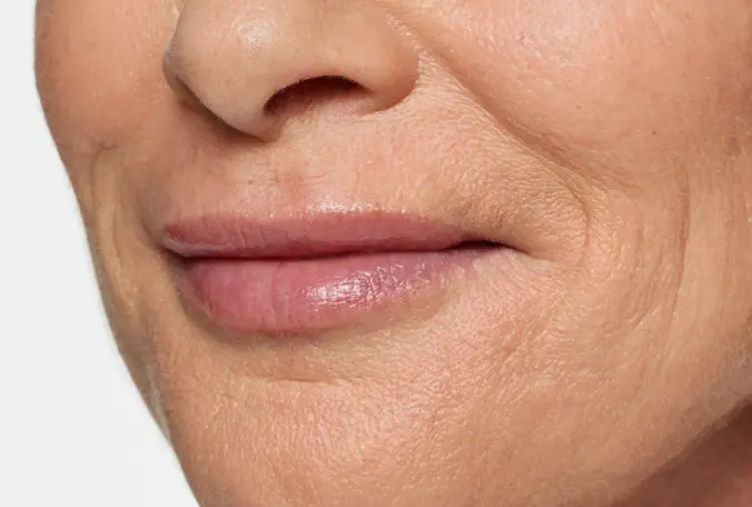 SANT Aesthetics & Regenerative Medicine after — Portland, OR